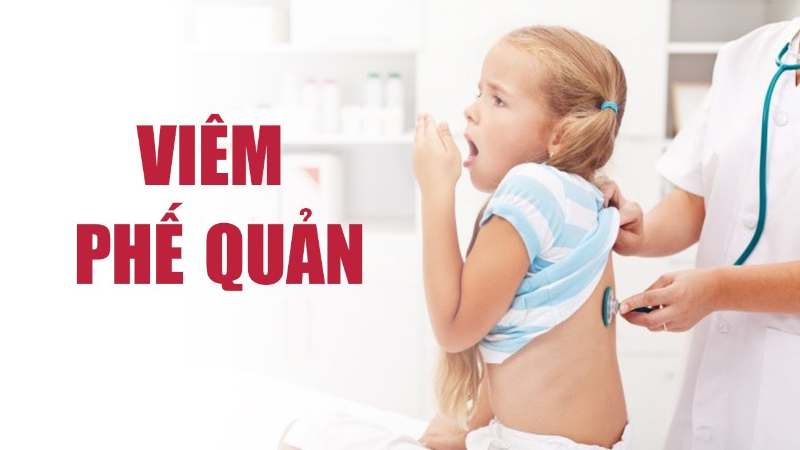 Viêm phế quản ở trẻ nếu không điều trị đúng cách có thể dẫn tới tử vong